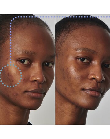 The INKEY Oil Solution Niacinamide Serum
